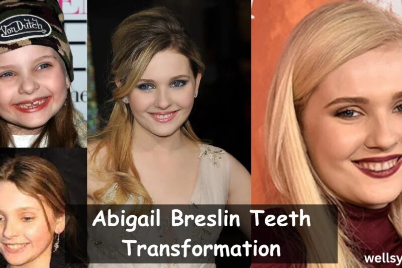 Abigail Breslin Teeth: The Real Reasons Her Smile Looks Different