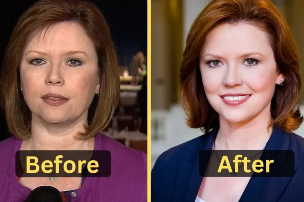 Kelly O'Donnell Weight Loss Before and After